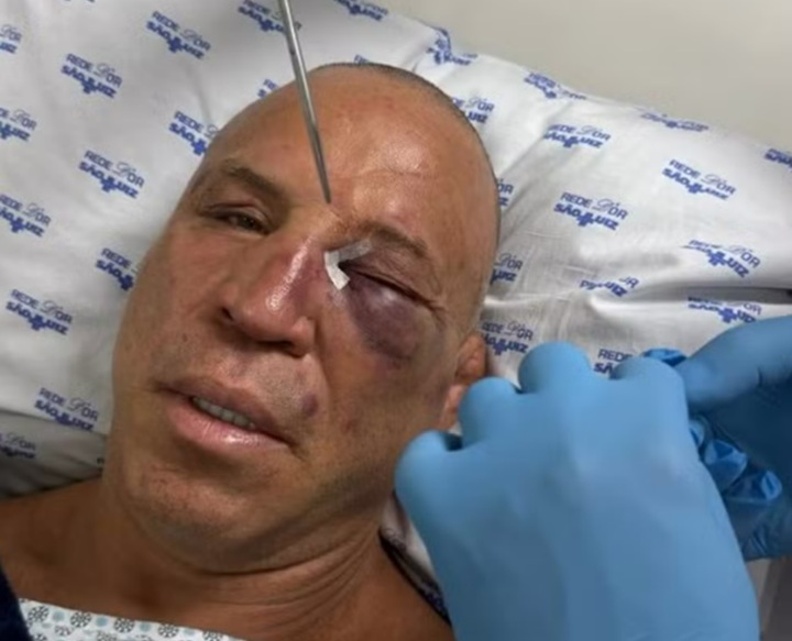 Wanderlei Silva precisou ser encaminhado ao hospital após cair desacordado ao levar um golpe durante confusão (Foto: Reprodução/Instagram)