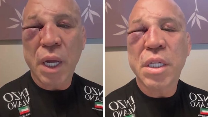 Wanderlei Silva atualizou seu estado de saúde após ser agredido e desmaiar durante a confusão logo depois de sua luta contra Popó (Foto: Reprodução)