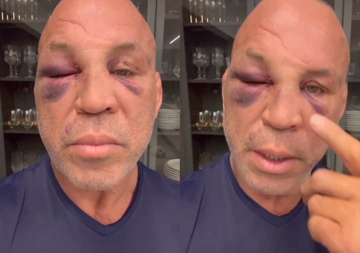 Em vídeo divulgado na madrugada desta terça (30), Wanderlei Silva atualizou os fãs sobre seu estado de saúde (Foto: Reprodução)