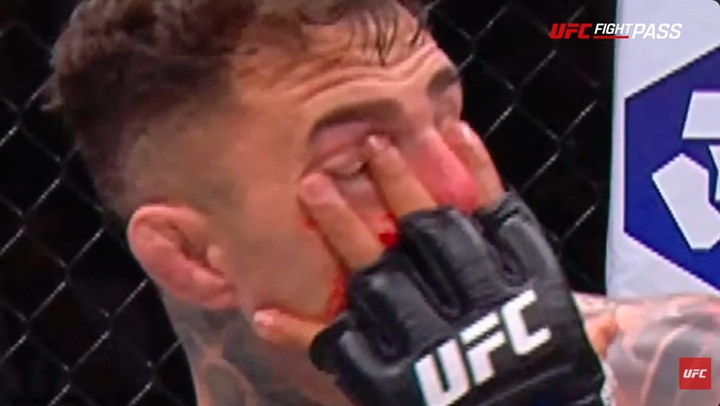 Tom Aspinall não teve condições de continuar na luta após receber uma dedada no olho de Ciryl Gane (Foto: Reprodução/UFC)