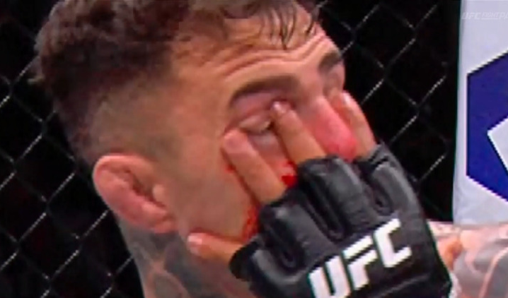 Aspinall sofreu uma dedada no olho e não conseguiu se manter na disputa no UFC 321 (Foto: Reprodução)