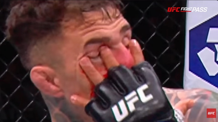 Tom Aspinall voltou a criticar Ciryl Gane por conta de dedada no olho durante o duelo entre eles no UFC 321, em outubro (Foto: Reprodução/UFC)