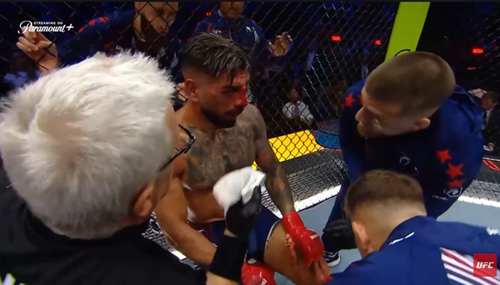 Ilia Topuria deixa evento com fraturas nos ossos orbitais e no nariz após batalha intensa contra Justin Gaethje (Foto: Reprodução/UFC)